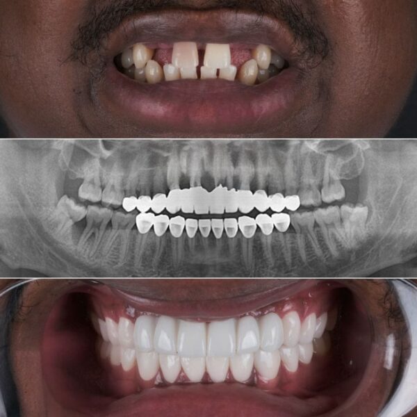 Dental Treatments – Safe and Lasting Solutions